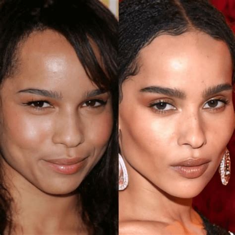 zoe kravitz ysl beauty|zoe kravitz cosmetic surgery.